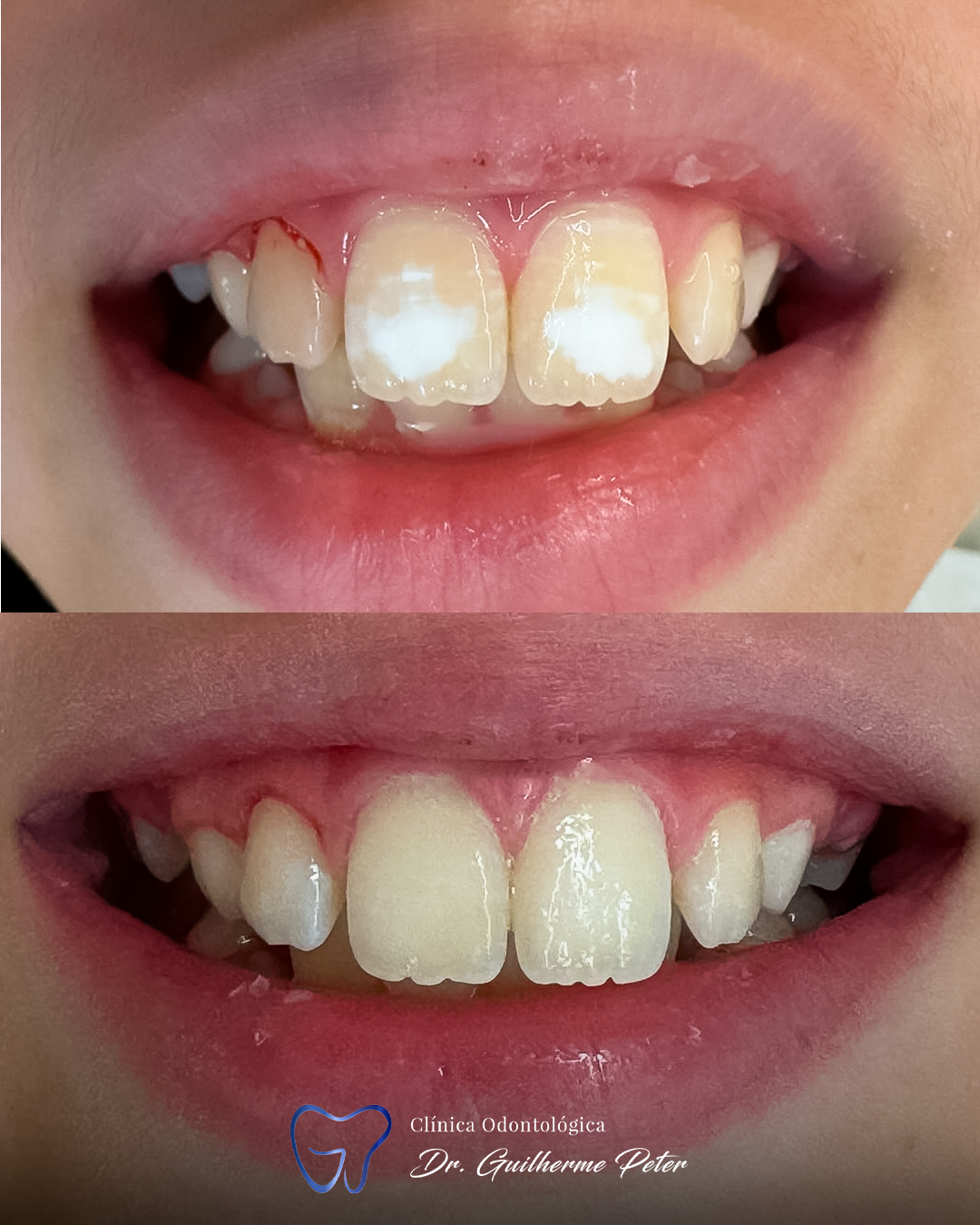 Resultado antes e depois 10