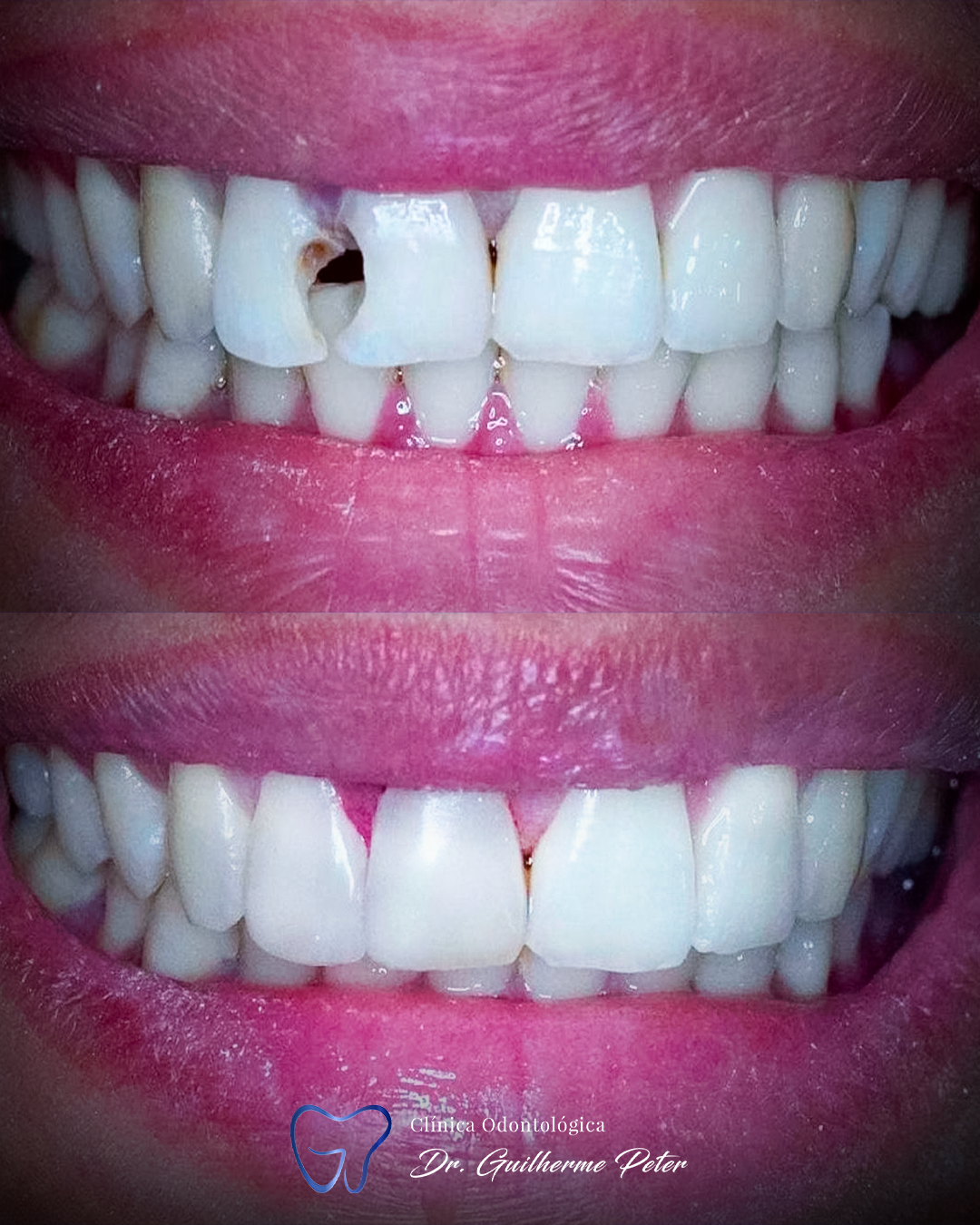 Resultado antes e depois 11