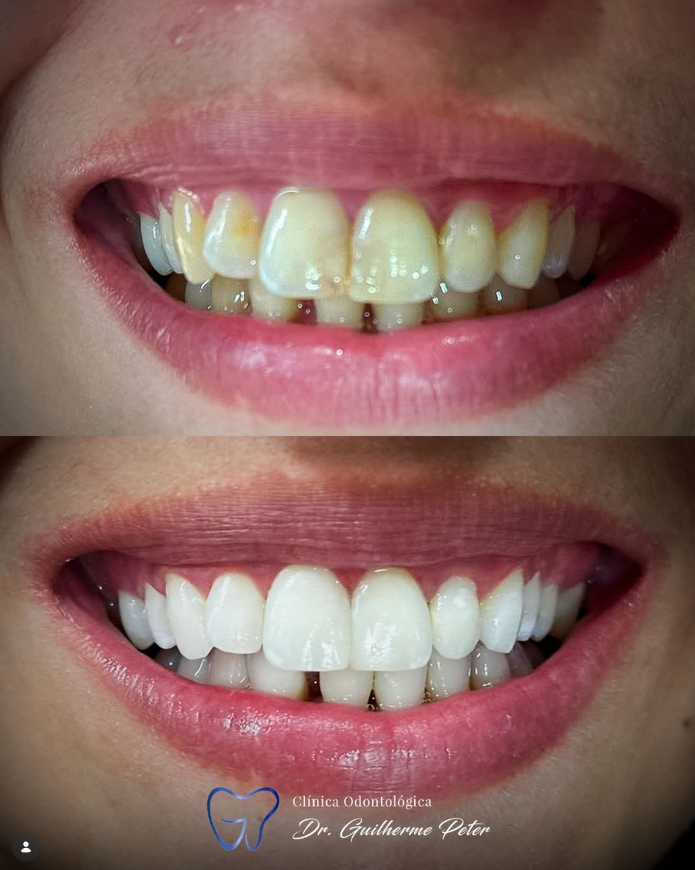 Resultado antes e depois 3