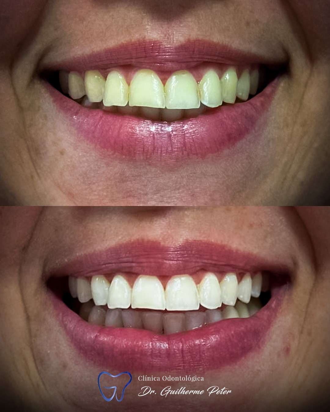 Resultado antes e depois 8
